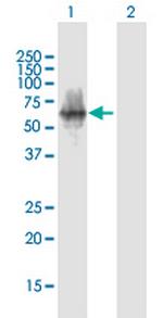 POTEA Polyclonal Antibody, MaxPab™