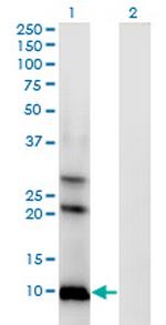 AKR1CL1 Monoclonal Antibody (4G8)