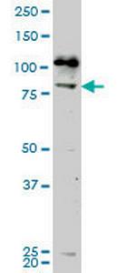 NEK5 Monoclonal Antibody (7G2)