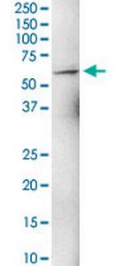 ZNF284 Polyclonal Antibody, MaxPab™