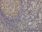 CDKL4 Monoclonal Antibody (6G8)