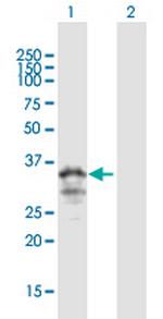 MOGAT3 Polyclonal Antibody, MaxPab™