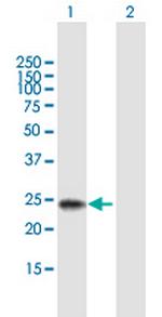 RBPMS2 Polyclonal Antibody, MaxPab™