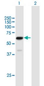 ZNF530 Antibody in Western Blot (WB)