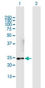 NMNAT3 Polyclonal Antibody, MaxPab™
