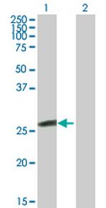GSTK1 Polyclonal Antibody, MaxPab™