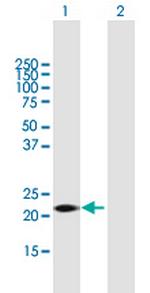 GSTK1 Polyclonal Antibody, MaxPab™