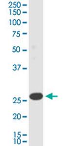TMEM179B Monoclonal Antibody (3G8)