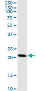 HDDC3 Monoclonal Antibody (7E6)