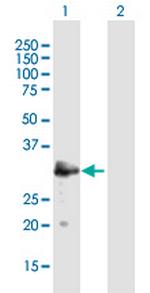 MAST4 Polyclonal Antibody, MaxPab™