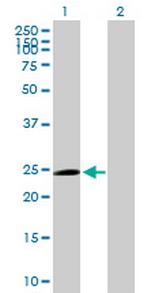 TRIM50C Antibody in Western Blot (WB)