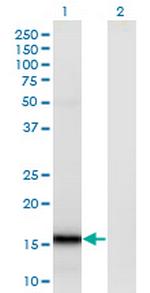 SUMO4 Monoclonal Antibody (1D3)