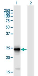 FIBIN Antibody in Western Blot (WB)