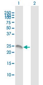 ANXA2R Antibody in Western Blot (WB)
