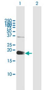ZCCHC13 Polyclonal Antibody, MaxPab™