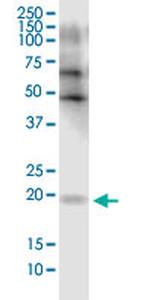 FLJ35767 Monoclonal Antibody (2F3)