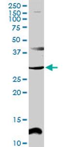 CENPP Antibody in Western Blot (WB)