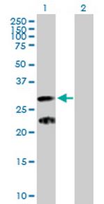 C9orf152 Antibody in Western Blot (WB)