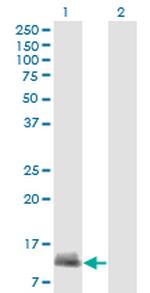 CARD17 Antibody in Western Blot (WB)