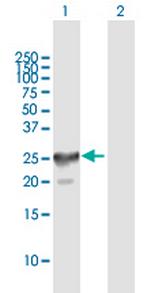 CT45-4 Polyclonal Antibody, MaxPab™
