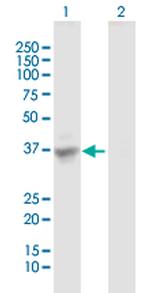 SULT1C3 Antibody in Western Blot (WB)