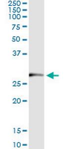TRIM72 Monoclonal Antibody (3B5)
