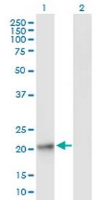 GPX8 Antibody in Western Blot (WB)