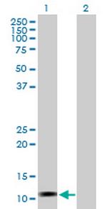 LOC541473 Antibody in Western Blot (WB)