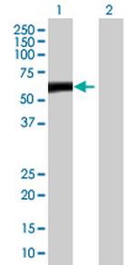ZBTB8 Polyclonal Antibody, MaxPab™