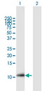 hCG_1731871 Polyclonal Antibody, MaxPab™
