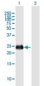 INS-IGF2 Polyclonal Antibody, MaxPab™
