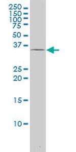 MEF2BNB Monoclonal Antibody (3E10)