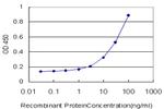 MEF2BNB Antibody in ELISA (ELISA)