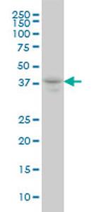 MEF2BNB Antibody in Western Blot (WB)