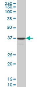 MEF2BNB Antibody in Western Blot (WB)