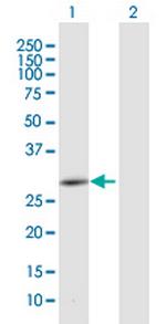 CEMP1 Polyclonal Antibody, MaxPab™