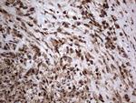 H2AFY2 Antibody in Immunohistochemistry (Paraffin) (IHC (P))