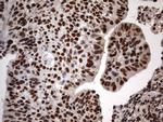 H2AFY2 Antibody in Immunohistochemistry (Paraffin) (IHC (P))