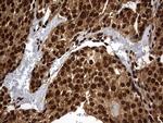 H2AFY2 Antibody in Immunohistochemistry (Paraffin) (IHC (P))