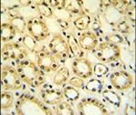 H6PD Antibody in Immunohistochemistry (IHC)