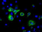 H6PD Antibody in Immunocytochemistry (ICC/IF)