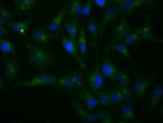 H6PD Antibody in Immunocytochemistry (ICC/IF)