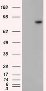 H6PD Antibody in Western Blot (WB)