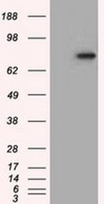 H6PD Antibody in Western Blot (WB)