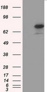 H6PD Antibody in Western Blot (WB)