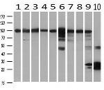 H6PD Antibody in Western Blot (WB)