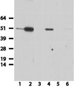 HA Tag Antibody in Western Blot (WB)