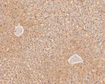 LSS Antibody in Immunohistochemistry (Paraffin) (IHC (P))
