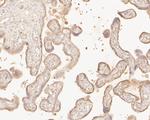 LSS Antibody in Immunohistochemistry (Paraffin) (IHC (P))