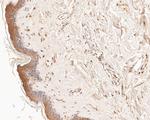 LSS Antibody in Immunohistochemistry (Paraffin) (IHC (P))